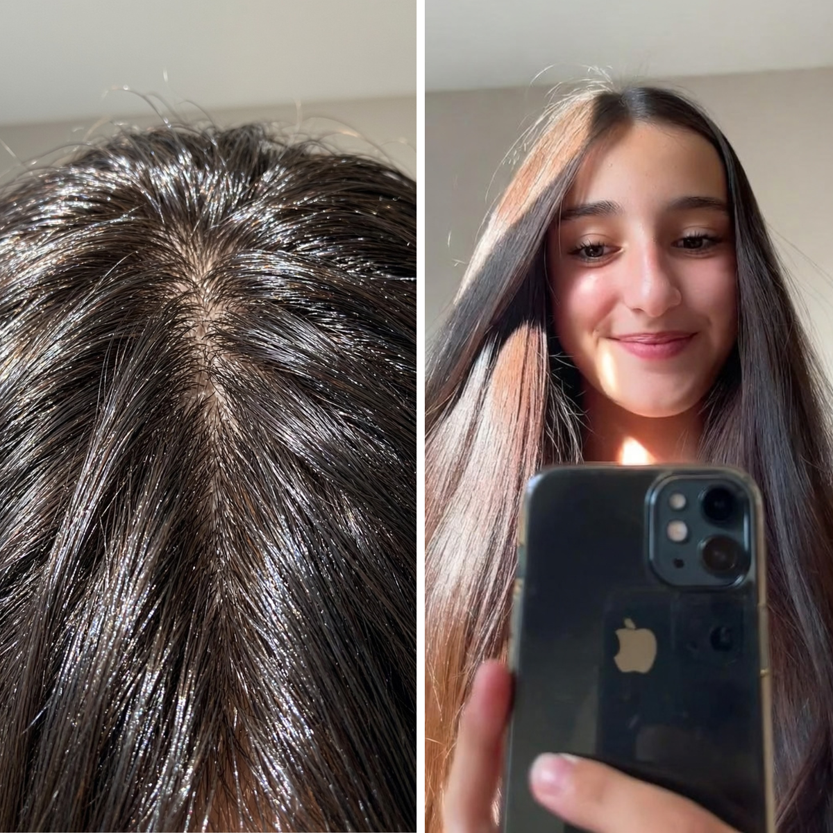 Her roots were getting greasy faster and faster.