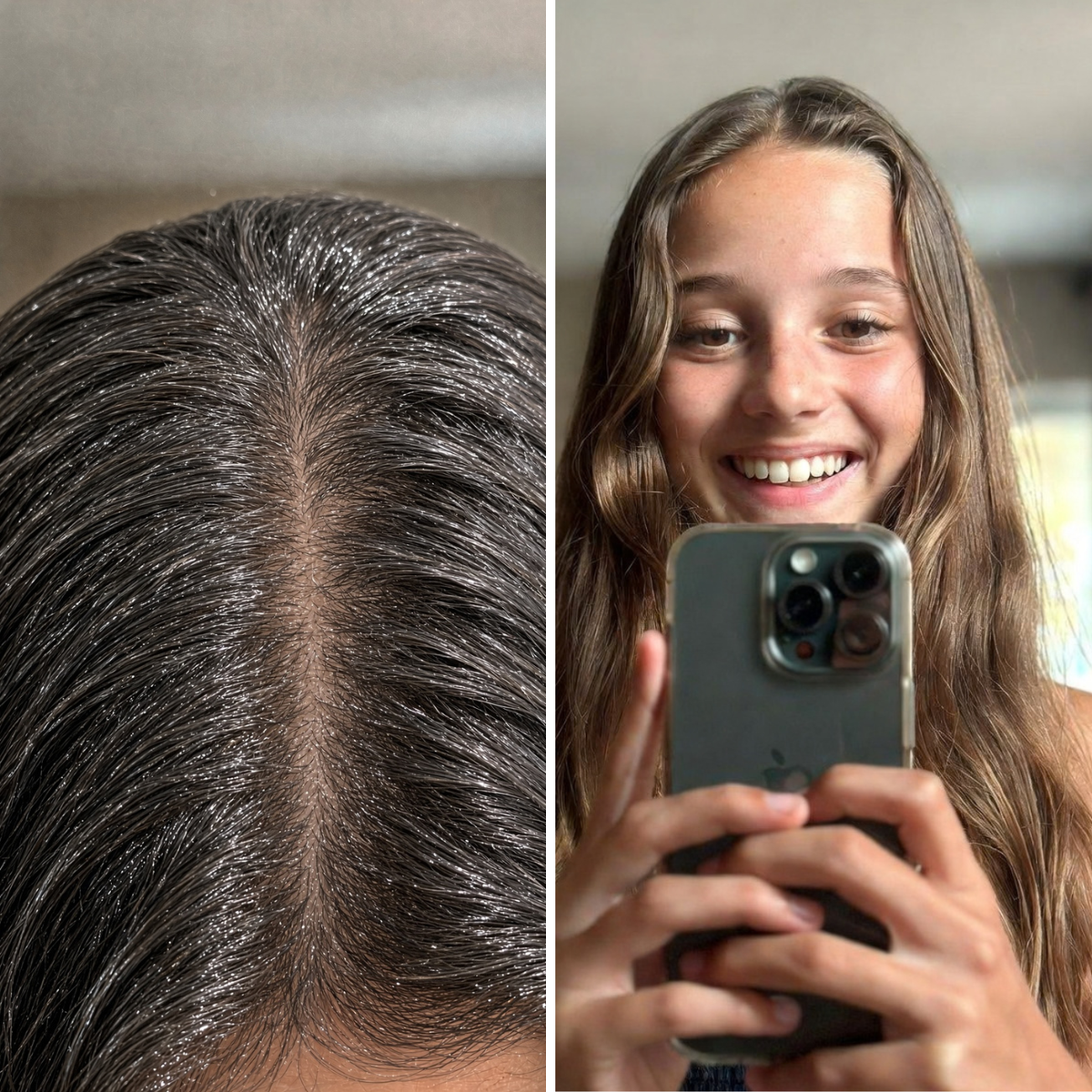 My daughter finally feels comfortable with her hair again.